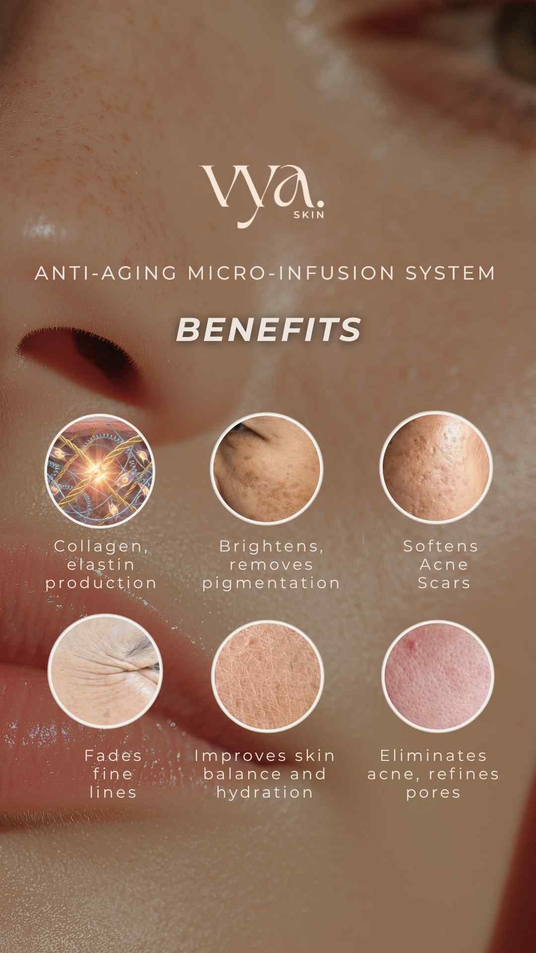 Anti-Aging Microinfusion Kit - VYA Skin
