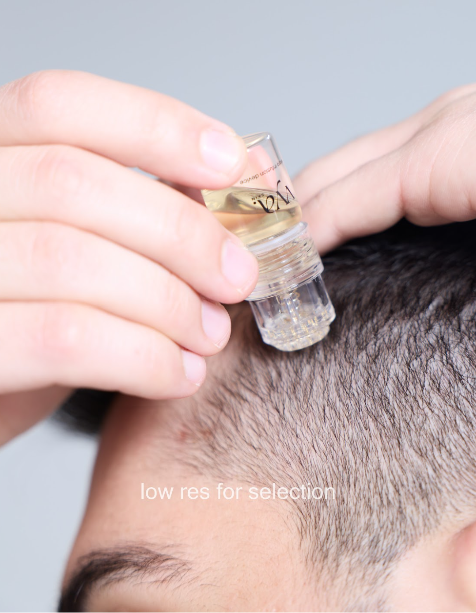 treatment for thinning hair that improves scalp absorption and supports hair density